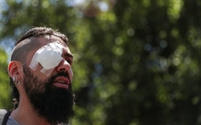 Images_172053_thumb_organismos-internacionales-denunciado-abusos-policiales_0_43_800_497