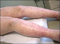 Images_32612_thumb_24