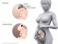 Images_62932_thumb_56