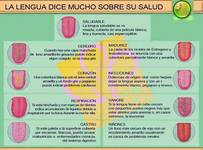 Images_91684_thumb_1